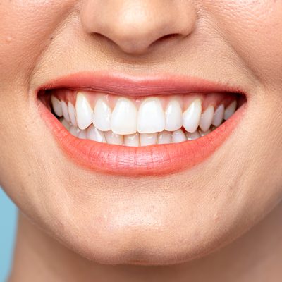 Dental Aesthetics & Implantology